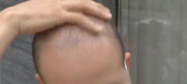 護理頭發一般多少錢（每根7元）