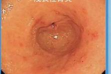 男性性功能检查要多少钱（体检查出这19种疾病）