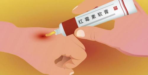红霉素软膏价格（1块钱的红霉素软膏功效多）