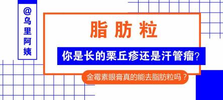 汗管瘤激光一次多少钱（为什么脂肪粒反反复复的长）