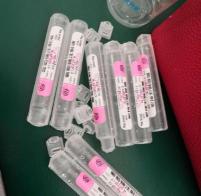 做糖耐多少钱（孕妇筛查血糖）