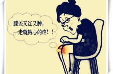 玻璃酸钠治疗膝关节多少钱（膝关节炎）