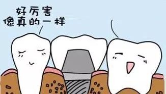 广州种牙多少钱柏德优（牙齿那些事儿）
