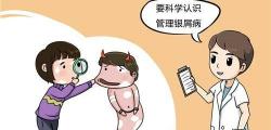 复方甘草酸苷片多少钱一盒（治疗银屑病）