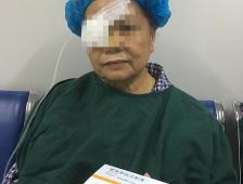 工伤一只眼睛失明赔偿多少钱（老太患眼病）