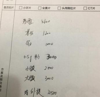 牙齿黄金多少钱（冷知识）