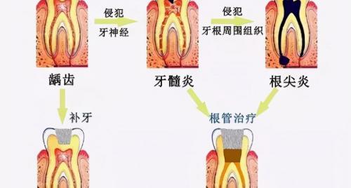 牙齿拍片多少钱（看个牙都要拍片）
