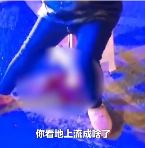 西寧做人流多少錢(qián)（西安處理）