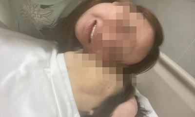 切脾手术需要多少钱（未找家属签字手术致66岁患者死亡）