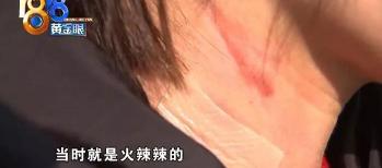 拔罐多少钱（美容店里拔火罐）