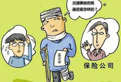 伤残鉴定多少钱（医院可以做伤残鉴定吗）