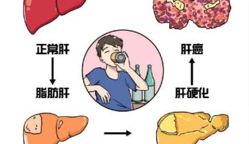 肝脏b超多少钱（检查肝脏）