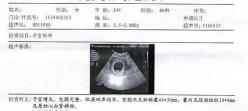 b超多少錢做一次（孕期到底要做幾次B超）