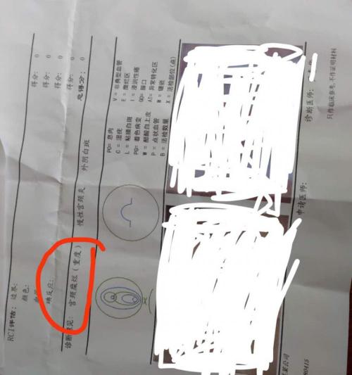 做宫颈糜烂手术多少钱（宫颈糜烂到底算疾病吗）