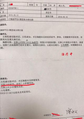 放疗25次需要多少钱（中医治疗肿瘤）