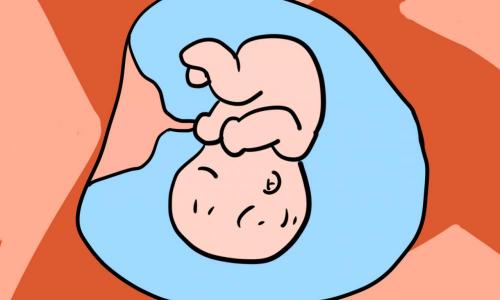 做无创dna要多少钱（双胎孕妈埋怨医生不给做唐筛）