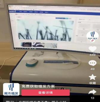 广州种发多少钱（起底高价植发套路）