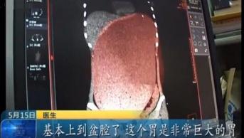 瘦哆啦多少钱一盒（减肥不当很可怕）