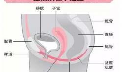 盆底肌做10次多少钱（用1000元去医院做盆底肌修复比在家做瑜伽恢复快10000倍）