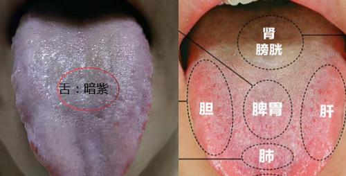 血府逐瘀片多少钱一盒（体内有瘀用血府逐瘀没用）