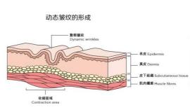 hutox彩毒多少钱一支（肉毒素行业深度报告）