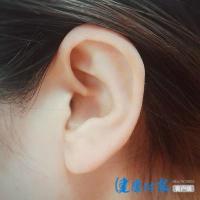 医院掏耳屎多少钱（掏个耳朵竟然被收1700元）