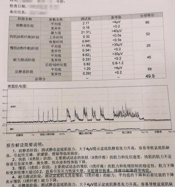 盆底肌做10次多少錢（今年）