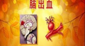 大脑ct检查多少钱（脑梗和脑出血是一种病吗）
