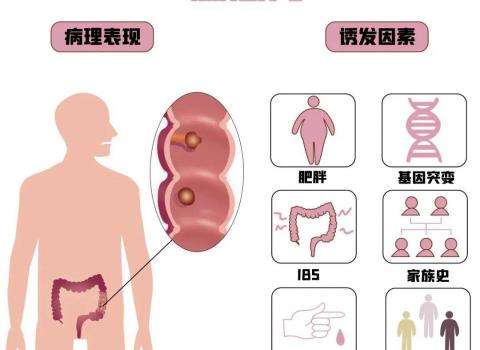 肠镜切除息肉多少钱（肠息肉）