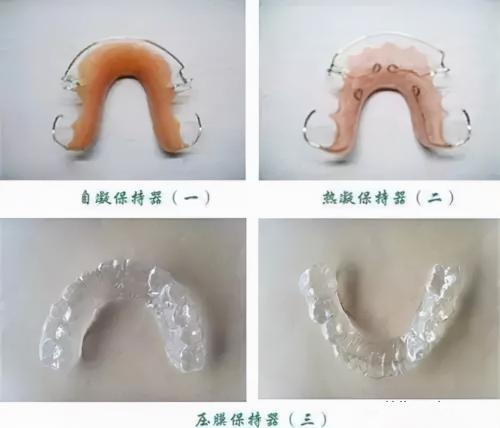 牙齿保持器多少钱一个（郑州牙齿矫正蔡留意教授）