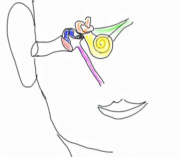 耳穿孔手术需要多少钱（爱耳日系列科普之中耳炎）