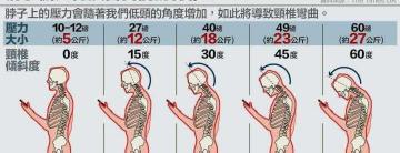 颈椎x光片多少钱（颈椎病）
