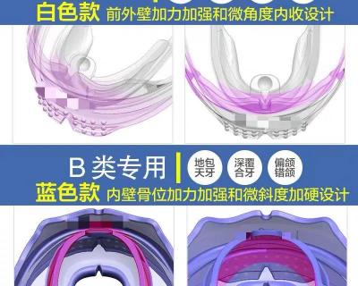 矫正2颗门牙多少钱（正畸日记）