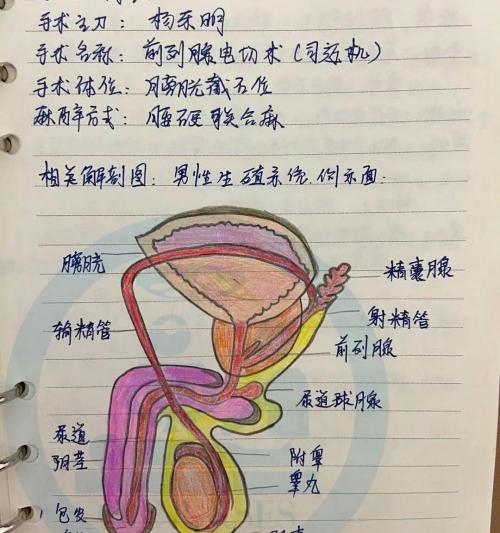 前列腺电切手术多少钱（手术笔记）