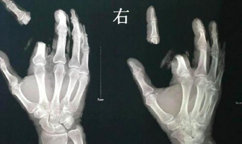 蟾蜍毒多少钱一克（有剧毒）