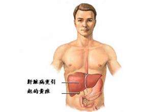 做引流多少錢一根（老人全身發(fā)黃似）