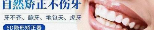装一颗门牙大概需要多少钱（一副牙套不过百）