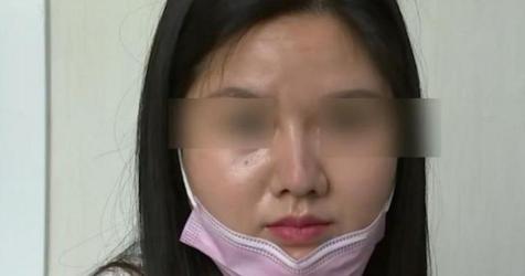 缩鼻翼手术多少钱（花4万5整鼻子）
