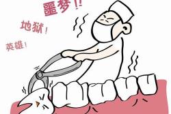 上海拔智齿要花多少钱（台州）