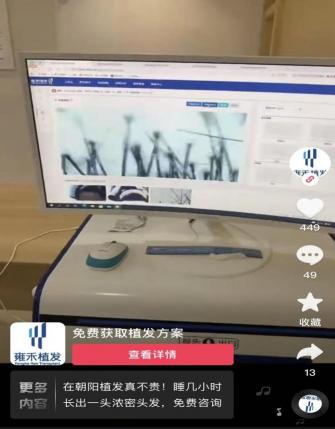 种眉毛大约需要多少钱（起底高价植发套路）
