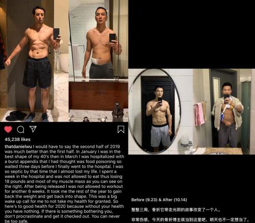 锁骨取钢板要多少钱（骑车时摔了一跤）