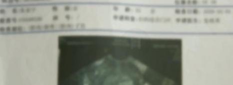 清宫需要多少钱呢（保胎不成）