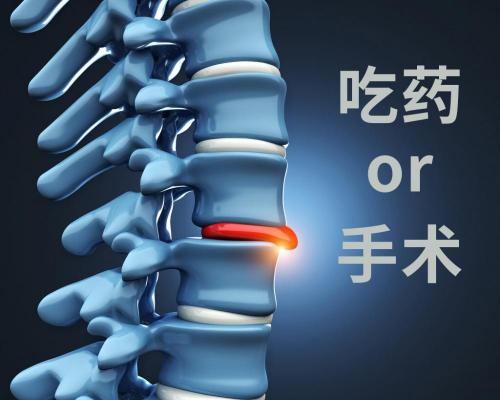 腰椎间盘突出手术多少钱（腰间盘突出症是吃药好还是做手术好）