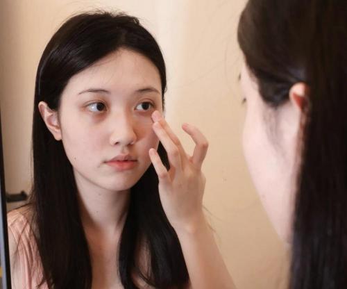 治療黑眼圈一般多少錢(4款去黑眼圈)