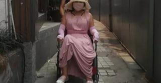 下颌骨手术一般多少钱（耗费400多万）