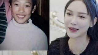 整脸型需要多少钱（14岁女孩被妈妈拉去整容）