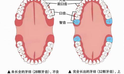 一般拔智齿多少钱一颗（智齿拔不拔）