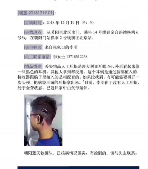 耳蜗多少钱一个（急寻的人工耳蜗）