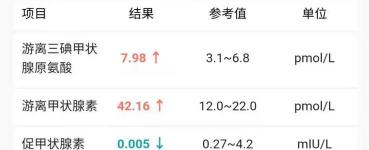 甲状腺功能五项多少钱（甲状腺功能报告单）