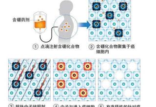 脑肿瘤能治好吗多少钱（10万元）